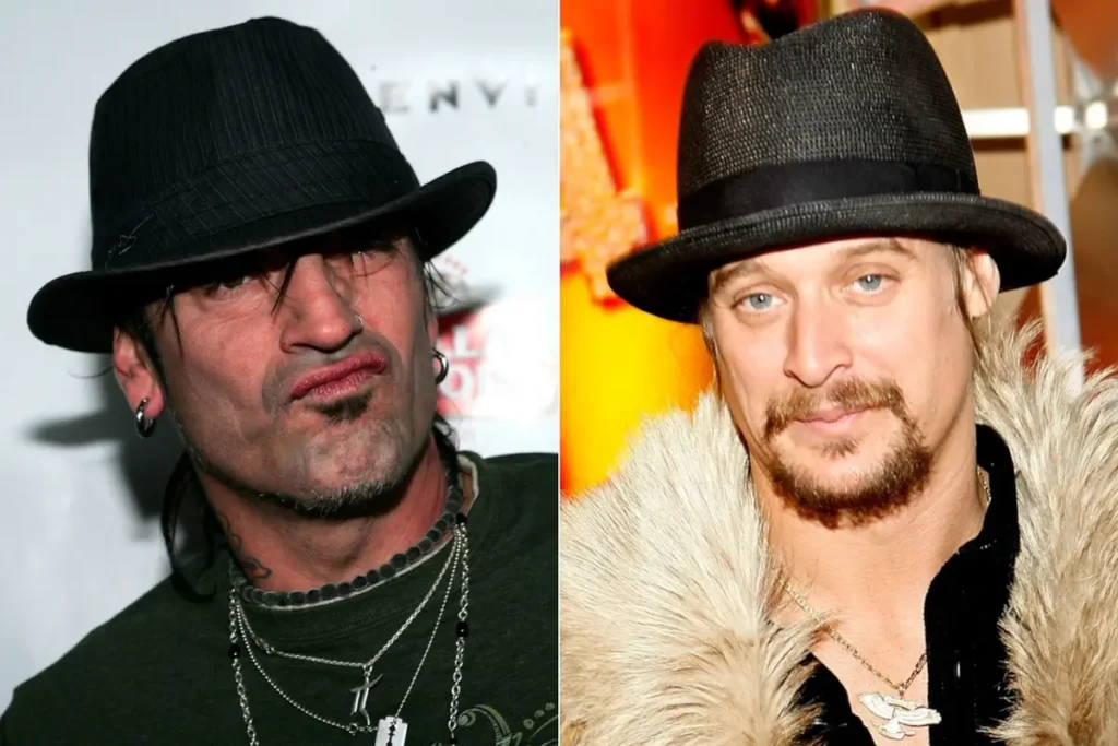 Tommy Lee